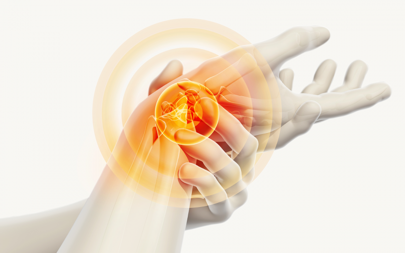 Medizinische Darstellung einer schmerzenden Hand mit hervorgehobenen Gelenken in leuchtendem Orange, symbolisierend für Handchirurgie oder Gelenkbeschwerden.