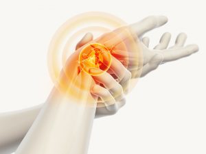 Medizinische Illustration eines schmerzenden Handgelenks, das von der anderen Hand gehalten wird. Der Schmerzbereich ist in Rot-Orange hervorgehoben.